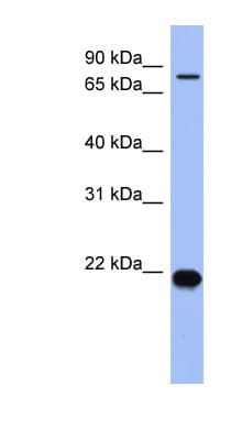 ZNF800 Antibody (N-Terminus)