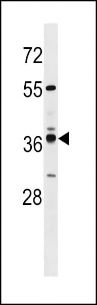 VN1R4 Antibody (aa193-219)