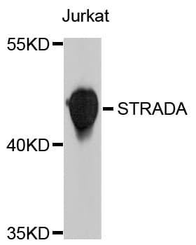 STRADA / LYK5 Antibody