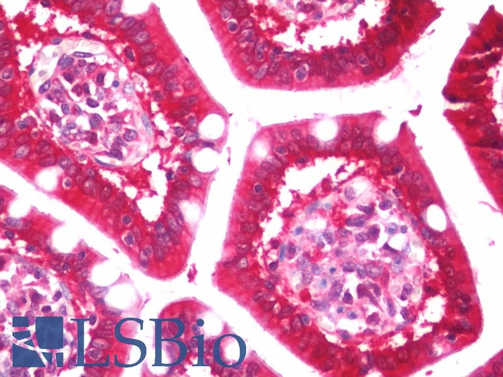 IHC-plus™ PYCARD / ASC / TMS1 Antibody
