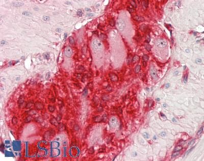 IHC-plus™ NUCB1 / Nucleobindin Antibody (clone 1H8-2C11)