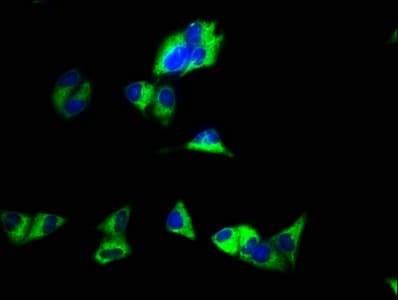 Polyclonal Rabbit anti-Human GJC1 / CX45 / Connexin 45 Antibody (IHC, IF, WB)