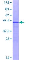 Human IL-10 Protein (Recombinant GST)