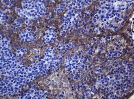 CDH1 / E Cadherin Antibody (clone OTI4F1)