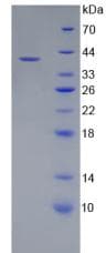Rat Complement C5a Protein (Recombinant His-GST)
