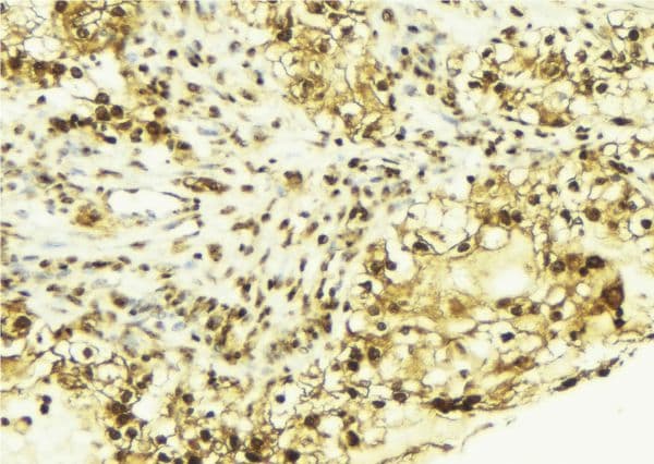 PRKCA / PKC-Alpha Antibody