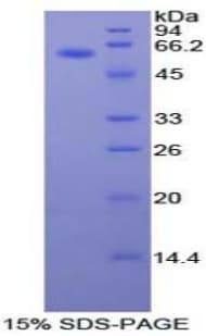 Rat EMA / MUC1 Protein (Recombinant His-GST)