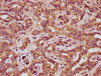 Polyclonal Rabbit anti-Human RCN3 Antibody (IHC)