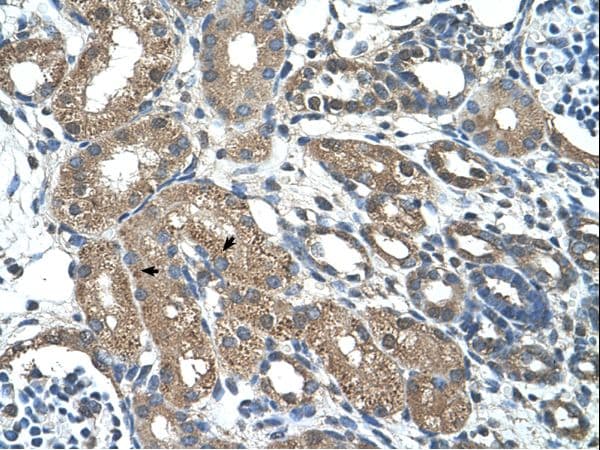 MAP3K7CL / TAK1L Antibody (aa151-200)