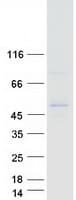 Human ALG1 Protein (Recombinant Myc-DDK (Flag))