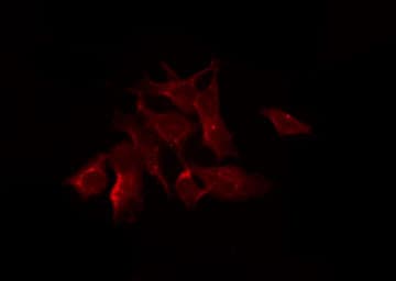Polyclonal Rabbit anti-Human DNAJB11 Antibody (IHC, IF, WB)