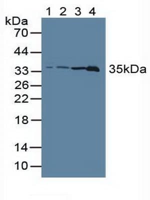 LDHC / Lactate Dehydrogenase C Antibody (aa1-332)