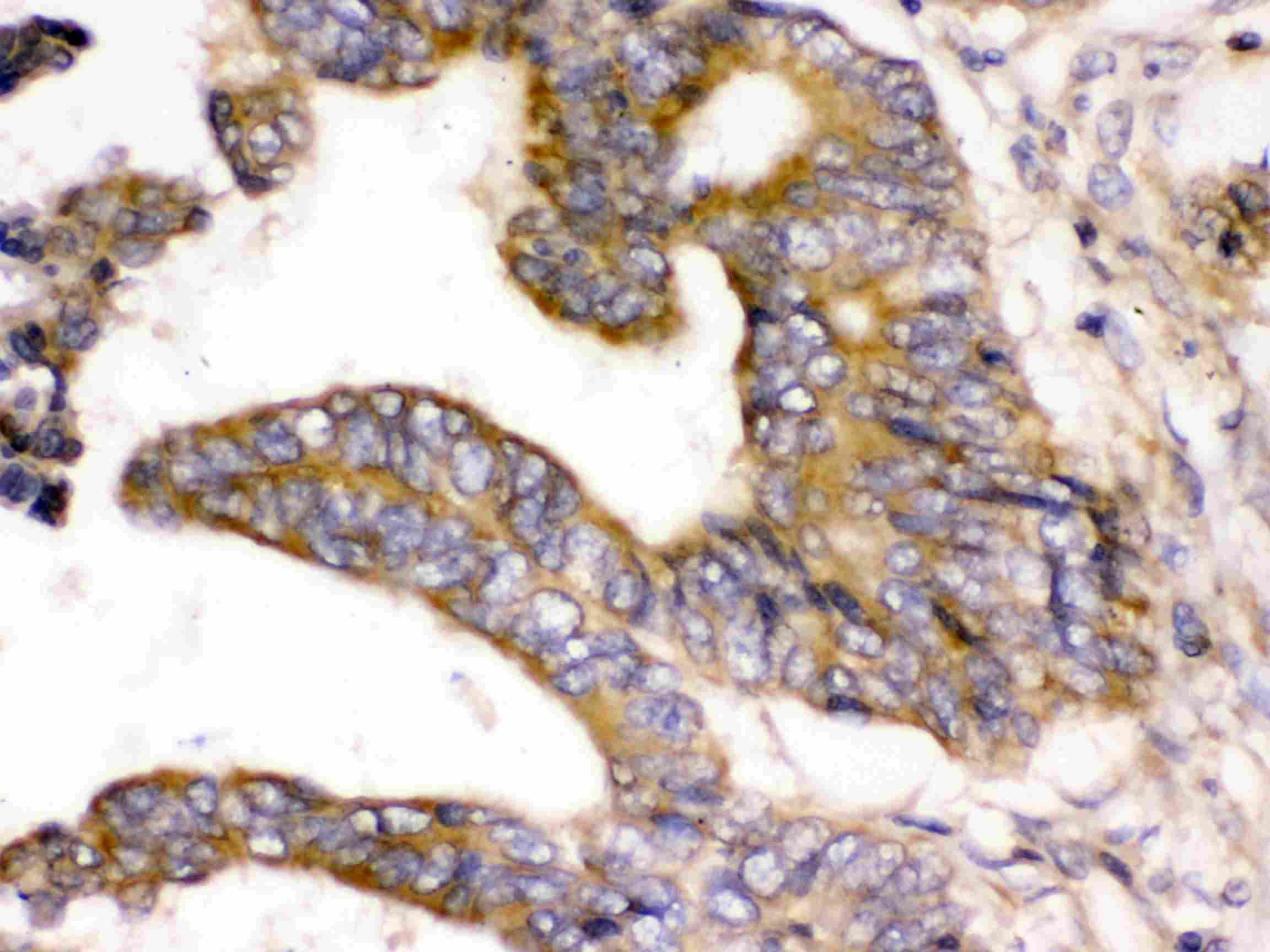Polyclonal Rabbit anti-Human WNK1 Antibody (IHC, WB)