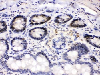 Polyclonal Rabbit anti-Human CDK4 Antibody (IHC, WB)