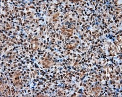 Monoclonal Mouse anti-Human ACLY / ATP Citrate Lyase Antibody (clone 3G8, Carrier-free, IHC, IF, WB)