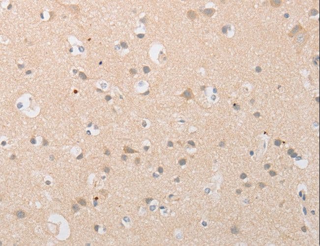 ATG9A Antibody