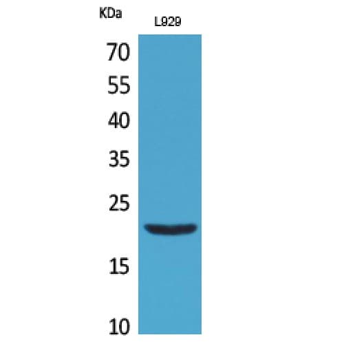 Polyclonal Rabbit anti-Human IFNL1 / IL29 Antibody (121-170 aa, Internal, WB)