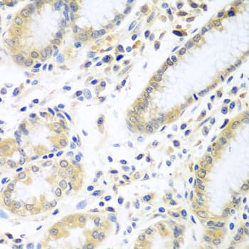 IL5 Antibody