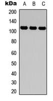 Polyclonal Rabbit anti-Human ITGA4 / VLA-4 / CD49d Antibody (Internal, WB)