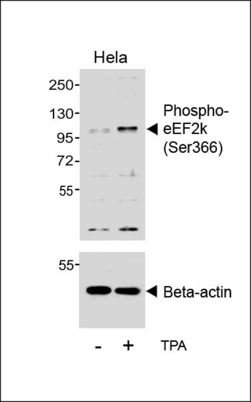 EEF2K Antibody (phospho-Ser366)