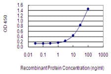 AFF2 / OX19 Antibody (clone 4D11)