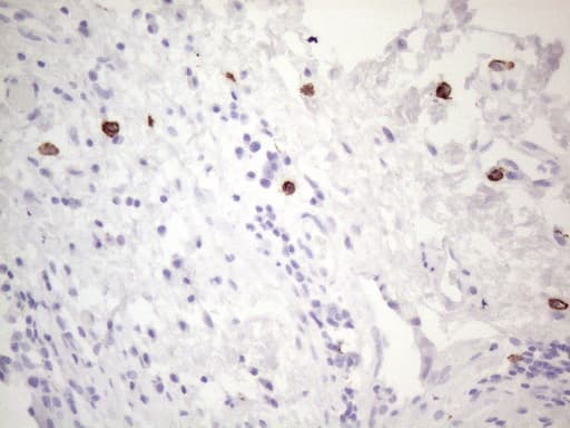 Monoclonal Mouse anti-Human c-Kit / CD117 Antibody (clone OTI2B12, aa27-308, IHC, WB)