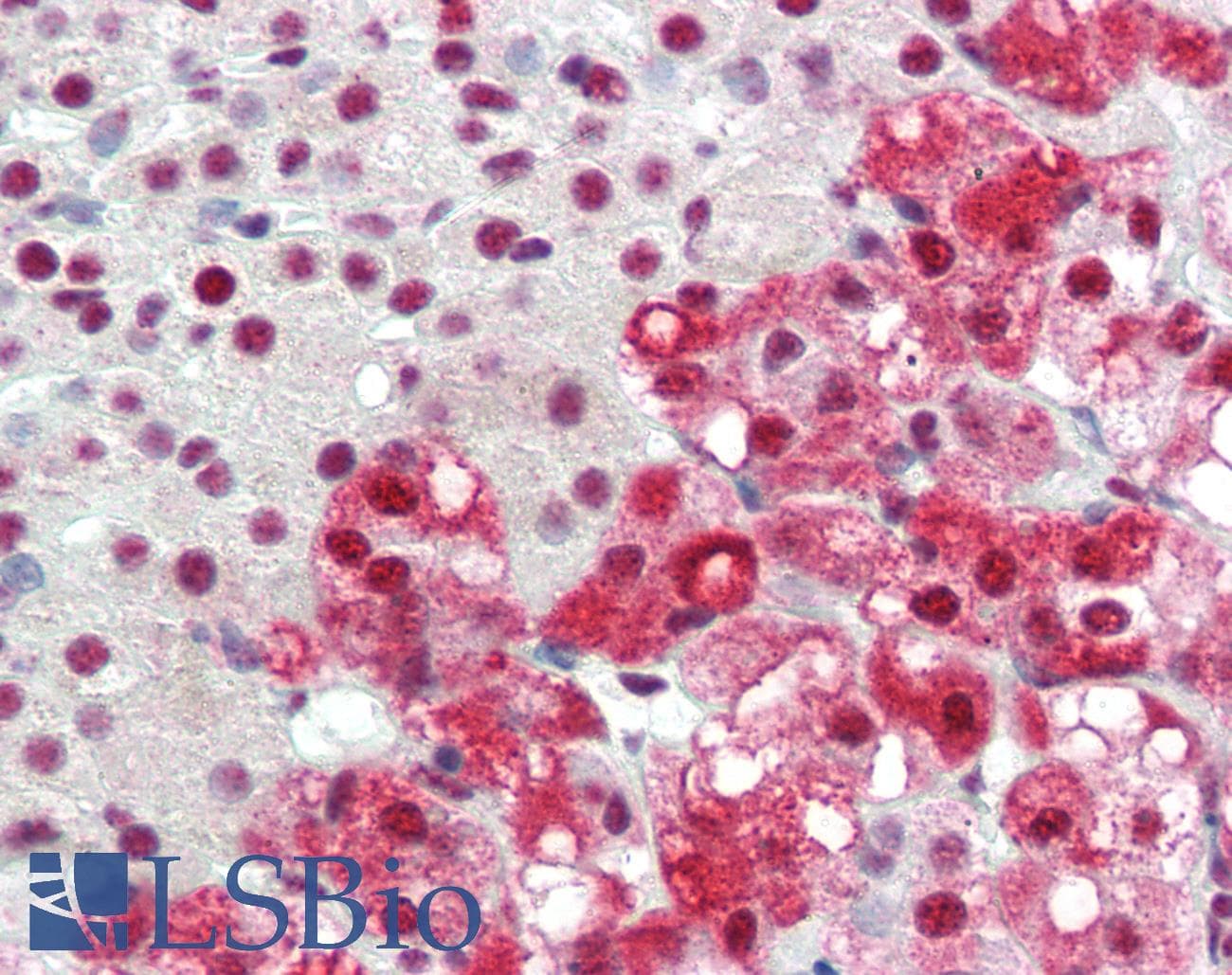 IHC-plus™ Polyclonal Rabbit anti-Human ID3 Antibody (C-Terminus, IHC)