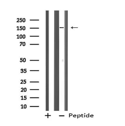 ZFYVE9 / SARA Antibody