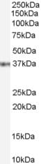 IHC-plus™ GBX2 Antibody (aa181-193)