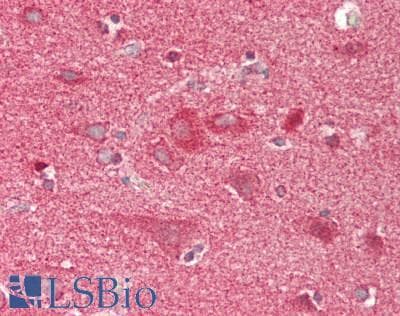 IHC-plus™ Polyclonal Rabbit anti-Human PFTK1 / CDK14 Antibody (aa67-96, IHC, WB)