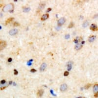 Polyclonal Rabbit anti-Human CCDC88A / GIV / Girdin Antibody (IHC, WB)