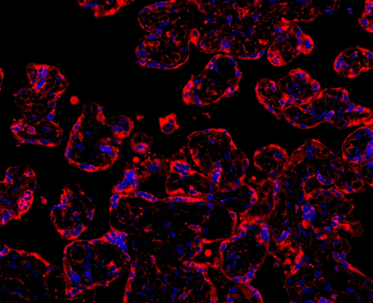 Polyclonal Rabbit anti-Human MYD88 Antibody (aa44-264, IHC, WB)