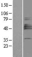 ST3GAL1 Protein (Over-Expression Lysate Myc-DDK (Flag))