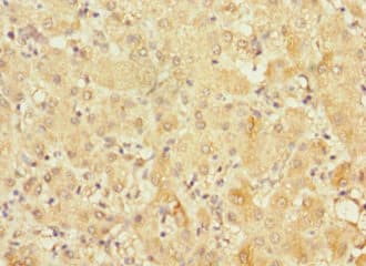 Polyclonal Rabbit anti-Human FRMD6 Antibody (IHC)