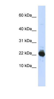 UBE2L3 / UBCH7 Antibody (aa35-84)