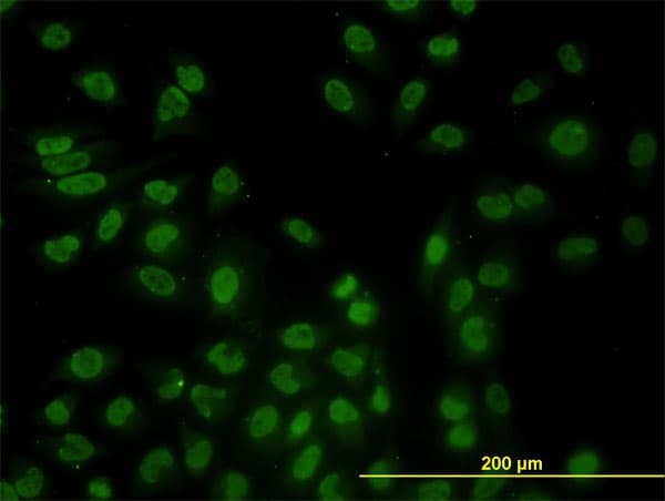 IHC-plus™ STK17B / DRAK2 Antibody (clone 2C3)