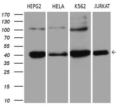 Monoclonal Mouse anti-Human ERLIN1 / SPFH1 Antibody (clone OTI4B1, aa107-346, IHC, WB)