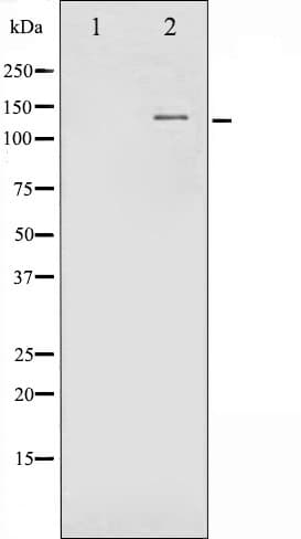 Polyclonal Rabbit anti-Human FGFR1 / FGF Receptor 1 Antibody (phospho-Tyr654, IF, WB)