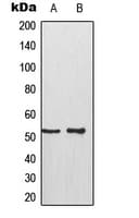 TP53 / p53 Antibody (phospho-Ser315)