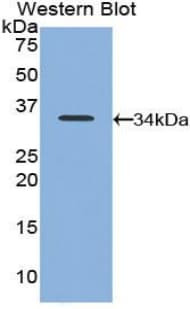 CD177 Antibody (aa193-468)