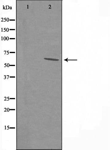 PPP1R16A Antibody