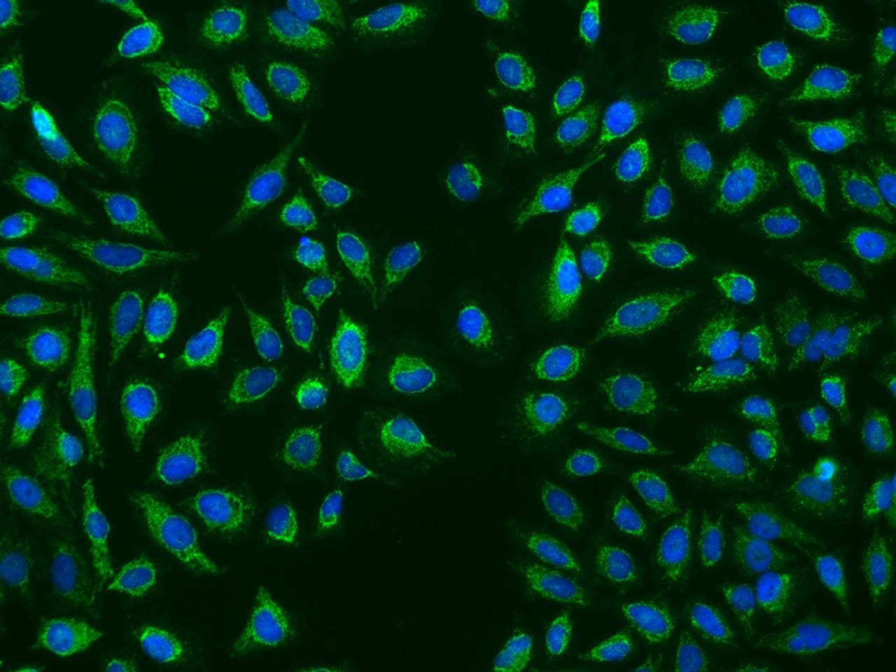 Polyclonal Rabbit anti-Human HMGCL Antibody (IHC, IF)