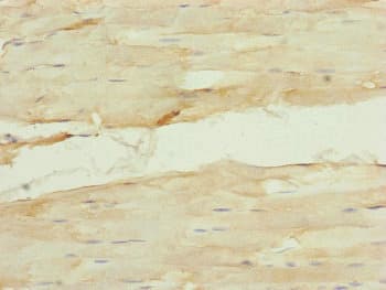 CDCA1 / NUF2 Antibody