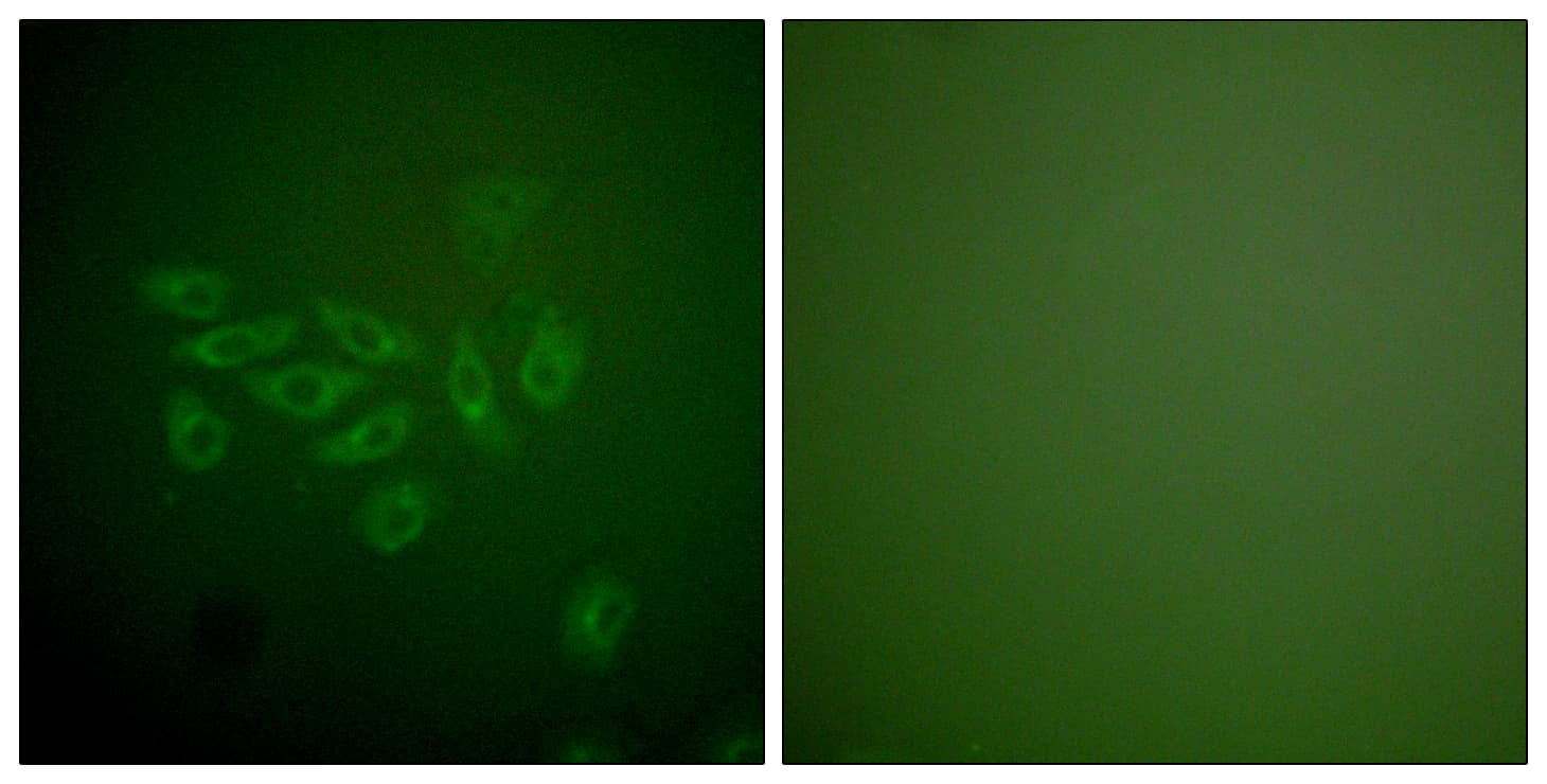 FHIT Antibody (aa81-130)