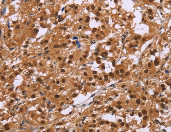 CTNNBL1 / NAP Antibody