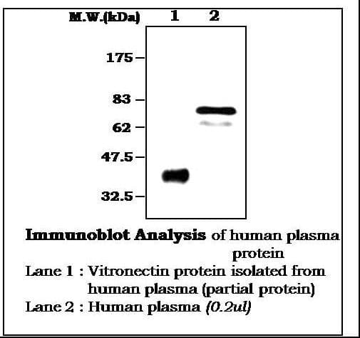 IHC-plus™ Monoclonal Mouse anti-Human VTN / Vitronectin Antibody (IHC, WB)