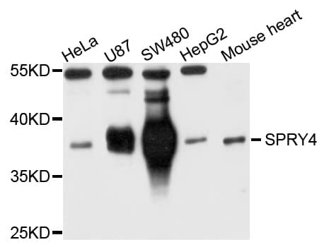 IHC-plus™ Sprouty 4 / SPRY4 Antibody