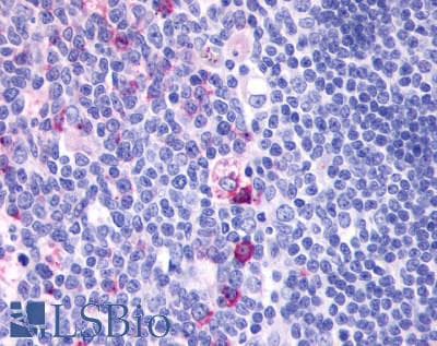PathPlus™ GPR137 Antibody (Extracellular Domain)
