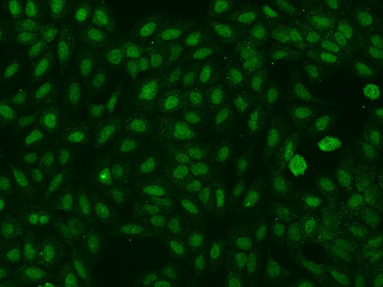 Polyclonal Rabbit anti-Human RBFOX1 / A2BP1 Antibody (IHC, IF)