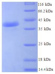 Human JOSD1 Protein (Recombinant His-SUMO)